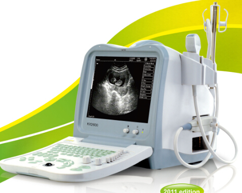 KX2600 portable dignostic ultrasound scanner