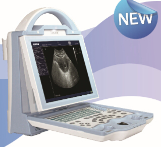 KX5600 full digital B mode  ultrasound scanner