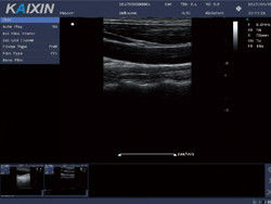 Instrumento de diagnóstico por ultrasonido Doppler digital de color DCU10